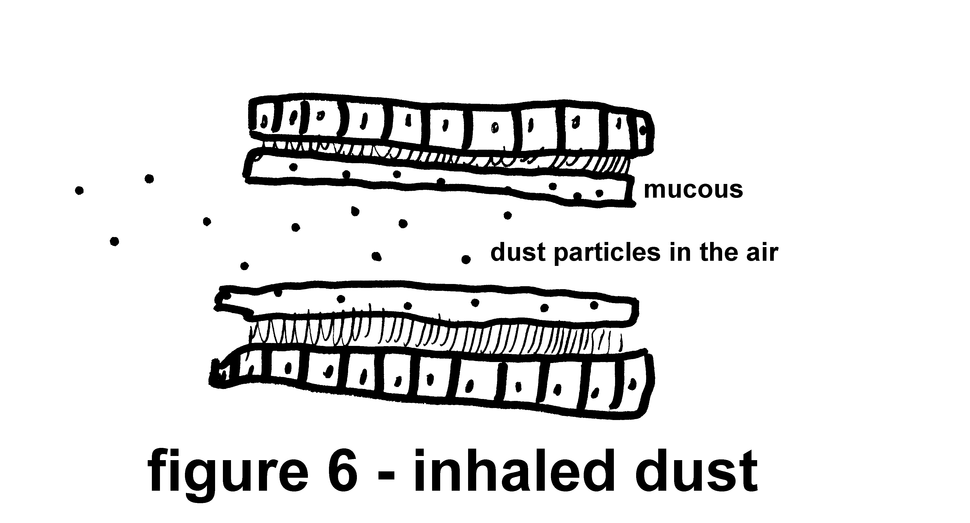 picture of Inhaled dust - Quit Smoking - The SMOKING CESSATION CLINIC